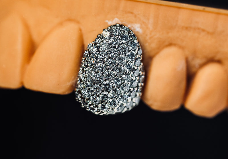 DIAMOND SET GRILLZ