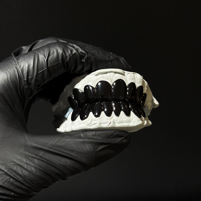BLACK CERAMIC GRILLZ
